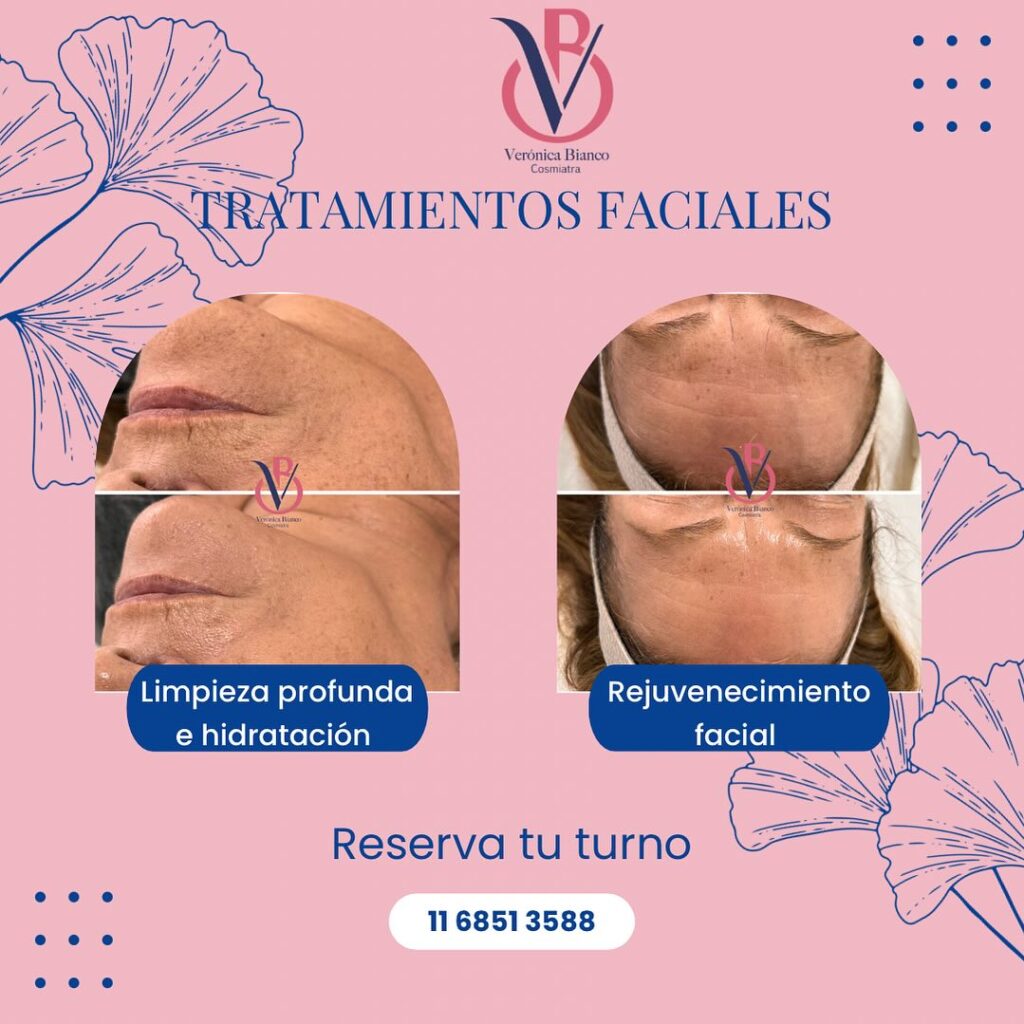 tratamientos faciales