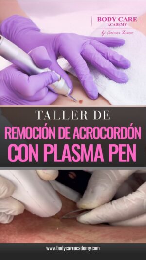 Remoción de Acrocordones<br>con PLASMA PEN