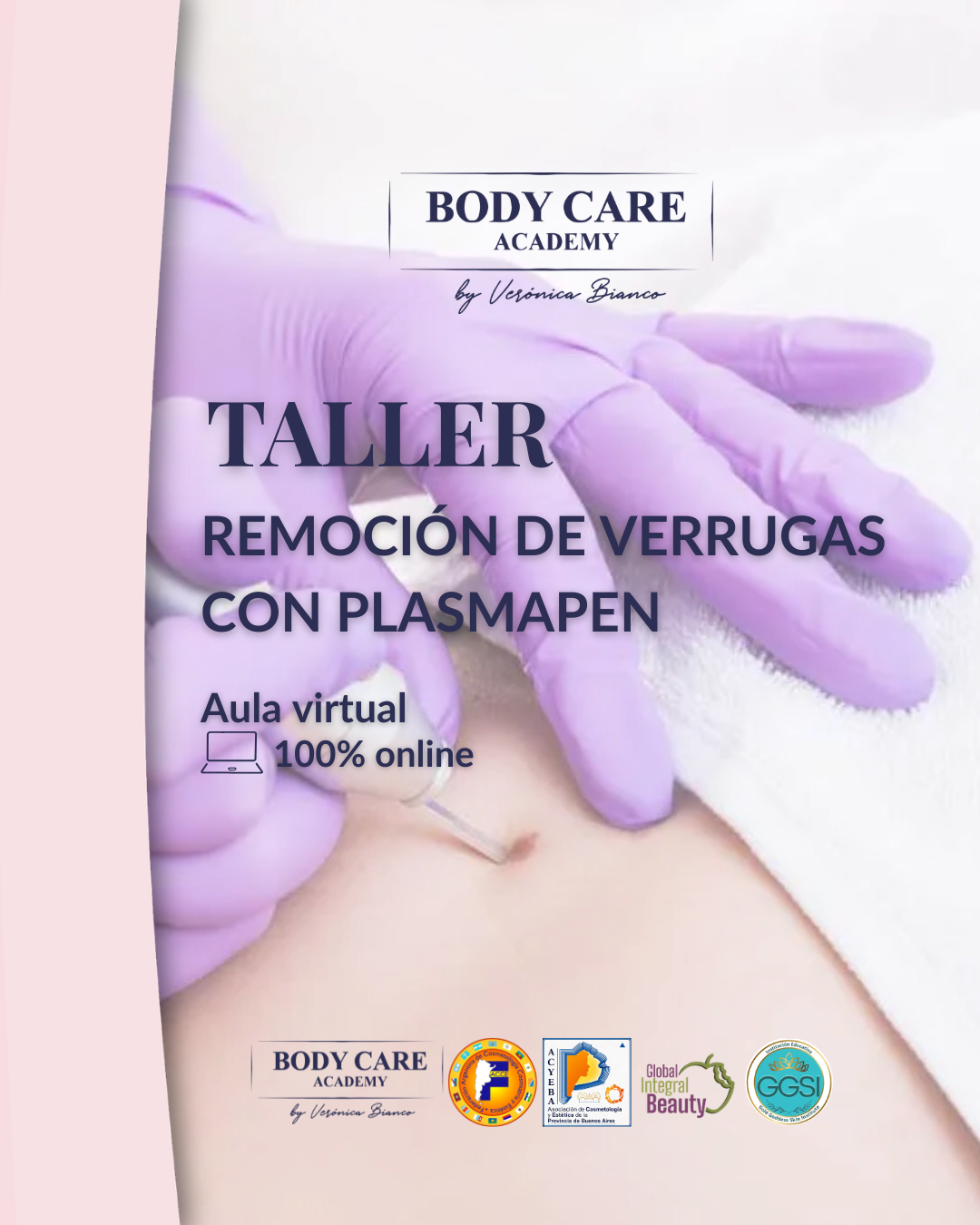 Remoción de Acrocordones<br>con PLASMA PEN